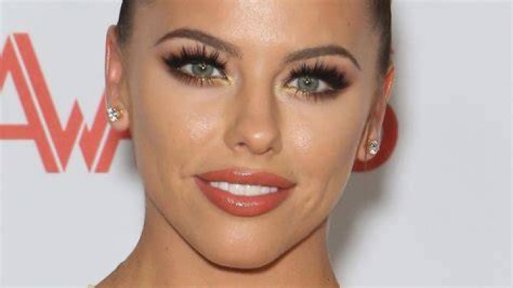 Adriana Chechik Updates Fans After Surgery For TwitchCon Injury