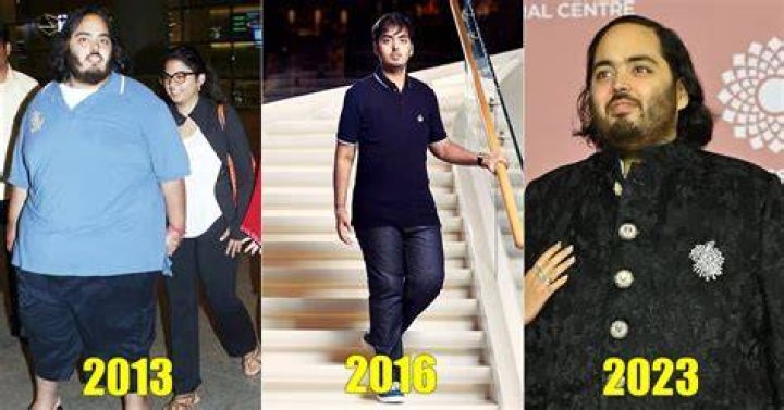 Anant Ambani's Medical Condition: A Complete Overview