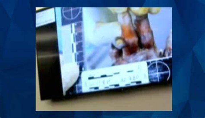 Gannon Stauch Autopsy Photos Shockingly Leaked: A Disturbing Case
